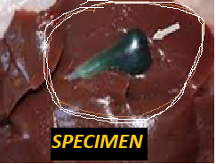 Specimen gallbladder