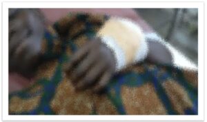 JHS Student Suffers Cutlass Wound After Allegedly Touching a Female Senior student’s Breast Repeatedly.